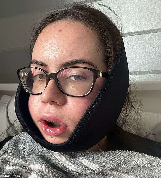Luisa McDermott's Transformative Journey: Overcoming a Severe Underbite with Double Jaw Surgery