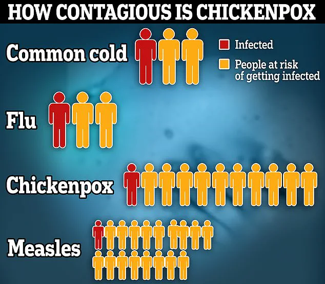 Mother Shares Experience of Toddler's Recovery from Common Chickenpox Infection