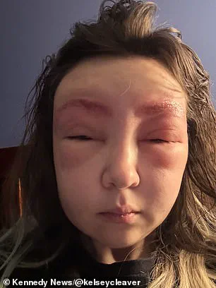 Alarming Aftermath of Eyebrow Tinting at Local Vancouver Salon