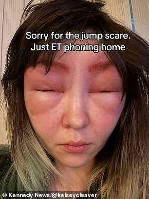 Alarming Aftermath of Eyebrow Tinting at Local Vancouver Salon