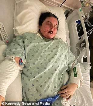 Behind Closed Doors: The Hidden Danger of Lamotrigine and the Medical Crisis That Changed Emily McAllister’s Life