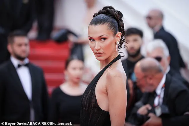 Surge in Female Hair Loss Sparks Calls for Public Awareness and Medical Action in the UK