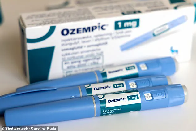 Surge in Female Hair Loss Sparks Calls for Public Awareness and Medical Action in the UK