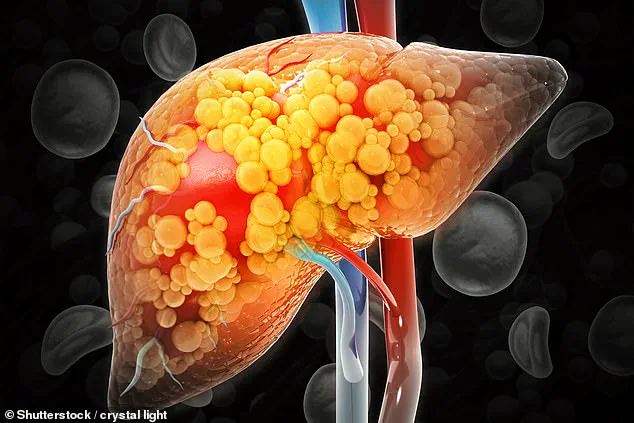 Experts Reveal How Weekly Exercise Can Combat Rising Liver Disease Rates in the UK, Advising 150 Minutes Weekly for Protection