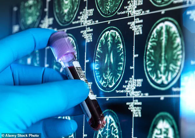Legal Care Needs Assessments Essential for Dementia Support, Says Specialist Nurse Victoria Lyons