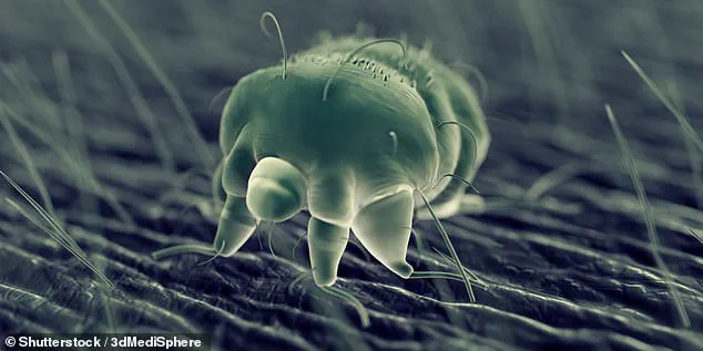 Persistent Itch Misdiagnosed as Allergy, Leading to Delayed Treatment