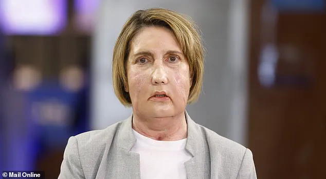 World's First Facial Transplant from Donor Who Chose Assisted Dying