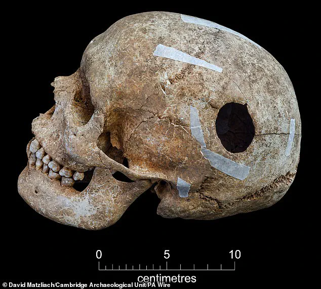 Cambridge Students Discover Viking Burial Pit with Violent Remains and a Mysterious Giant