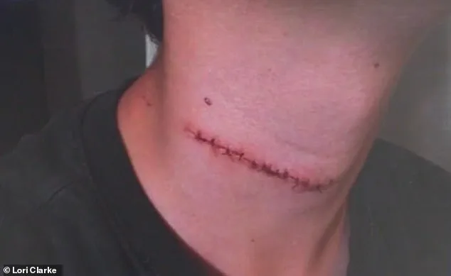 Family Vacation Turns Nightmare as 13-Year-Old Boy Suffers Life-Threatening Attack by Vagrant on Daytona Beach Boardwalk