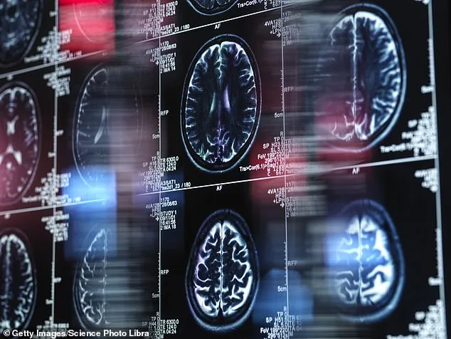 UK Dementia Crisis Deepens as Young-Onset Cases Surge and Underreporting Reveals Hidden Toll
