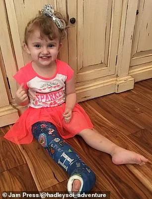 Shattered Joy: Baby's Fractures Lead to Abuse Accusations for Parents
