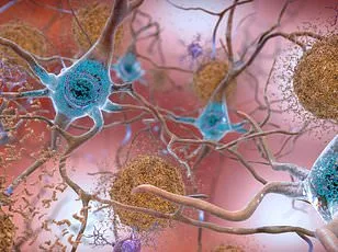 Breakthrough Study Shows Fluvoxamine May Alleviate Long COVID Fatigue, Outperforming Placebo in Clinical Trial