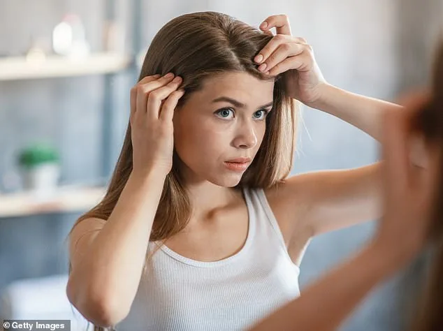 Malassezia Fungus: The Real Cause of Dandruff, Not Dryness
